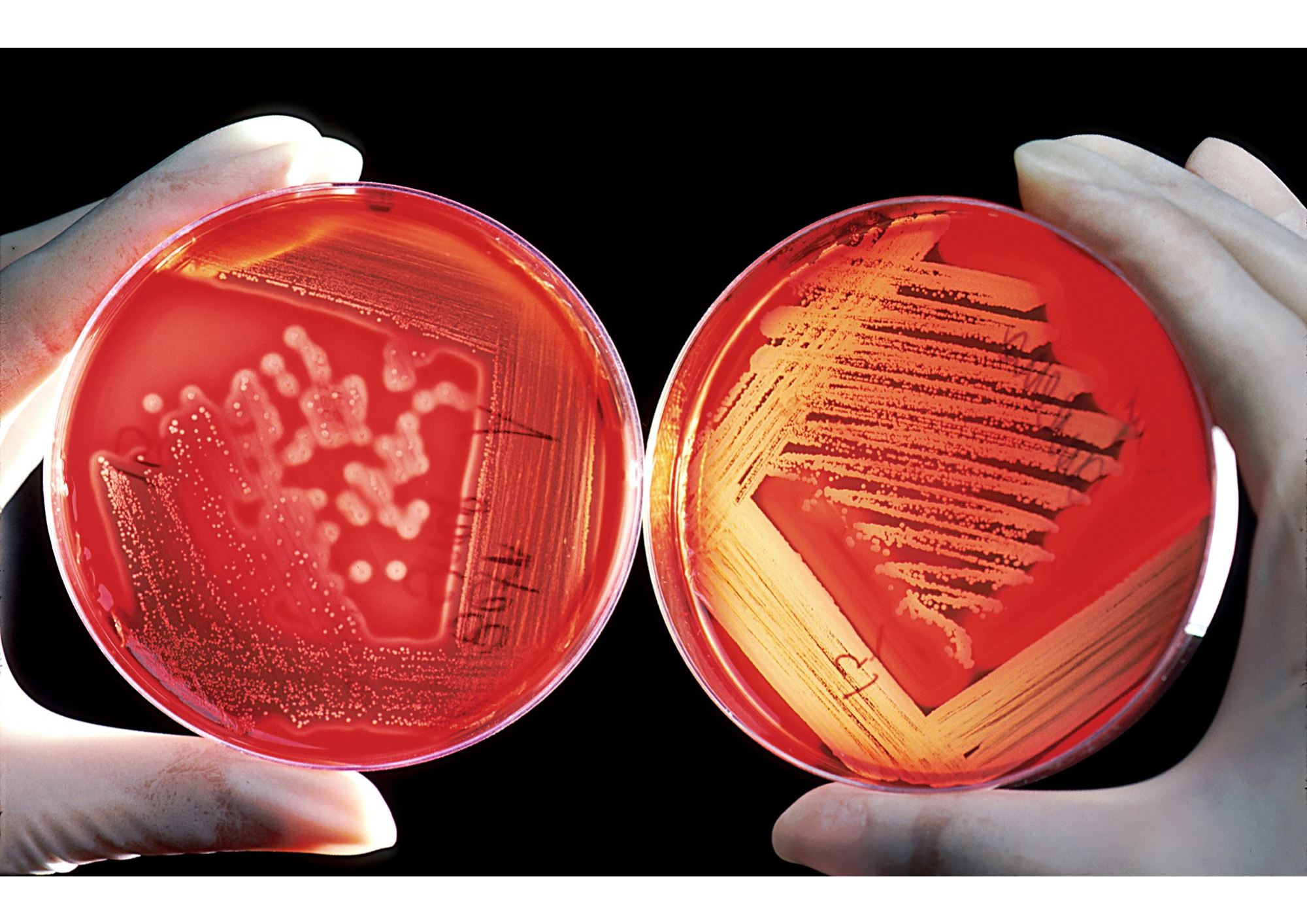 blodplatta  mikrobiologisk odling